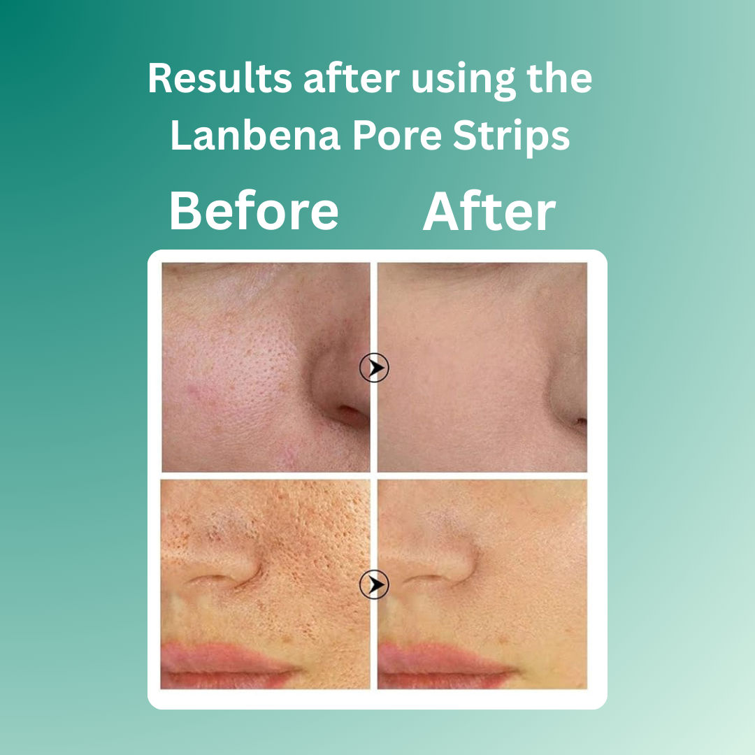 LANBENA Pore Strips
